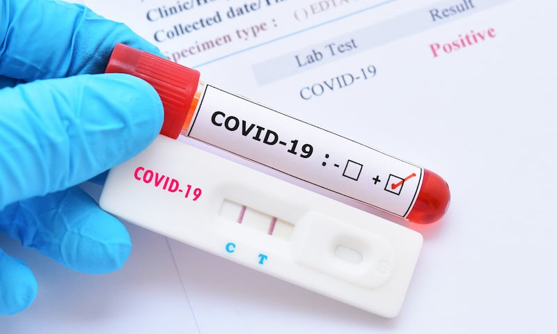 Workplace covid tests: avoiding the legal and practical pitfalls